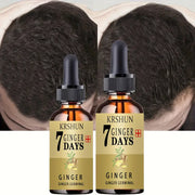 Ginger Serum for Promoting Hair Growth and Preventing Hair Loss