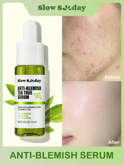 سيرم لعلاج الحبوب ومشكلات البشرة الدهنية  Clarifying Serum for Acne-Prone and Oily Skin