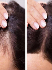 سيرم الشعر لزيادة كثافة الشعر ونعومته وطوله Hair Growth and density 