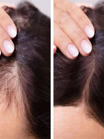 سيرم الشعر لزيادة كثافة الشعر ونعومته وطوله Hair Growth and density 